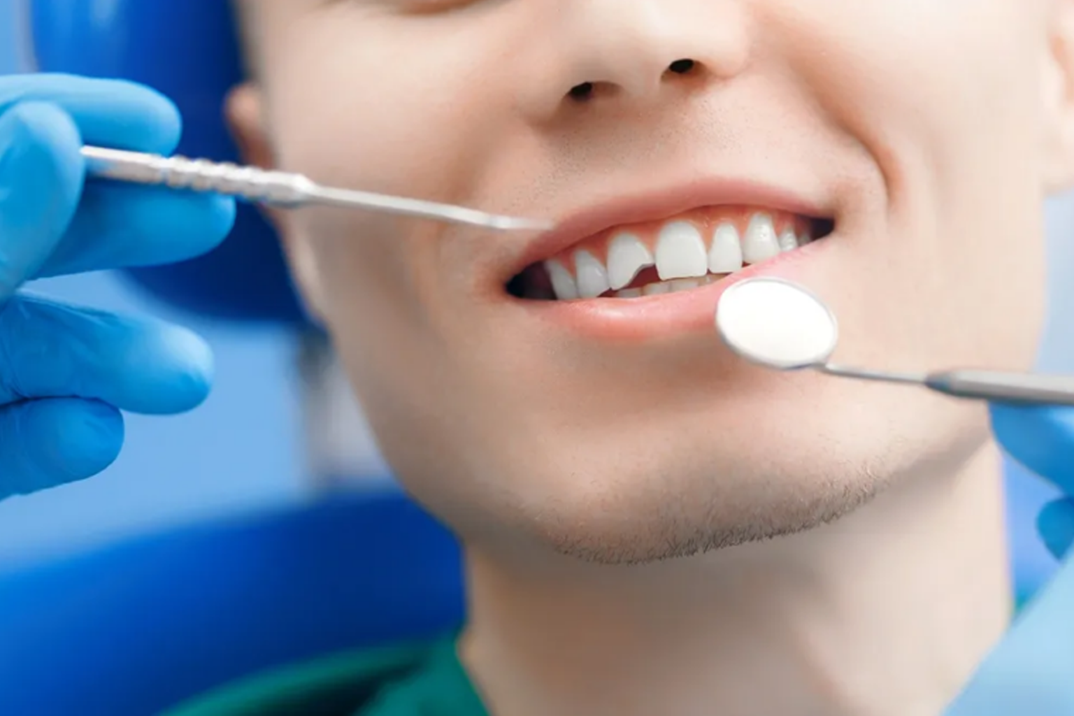 Broken or Fractured Tooth Treatment