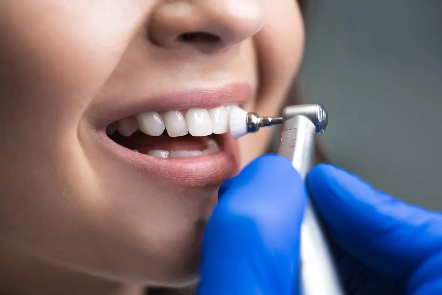 Dental Cleaning & Consultation