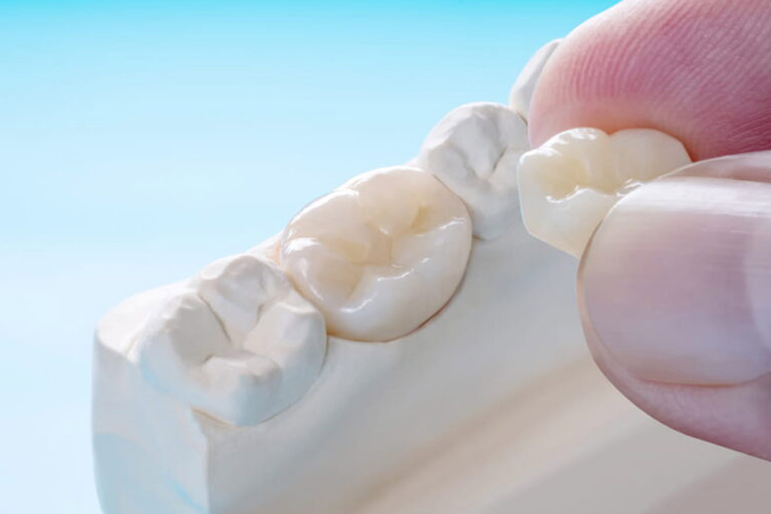 Closeup / Prosthodontics or Prosthetic / Single teeth crown and bridge equipment model express fix restoration.