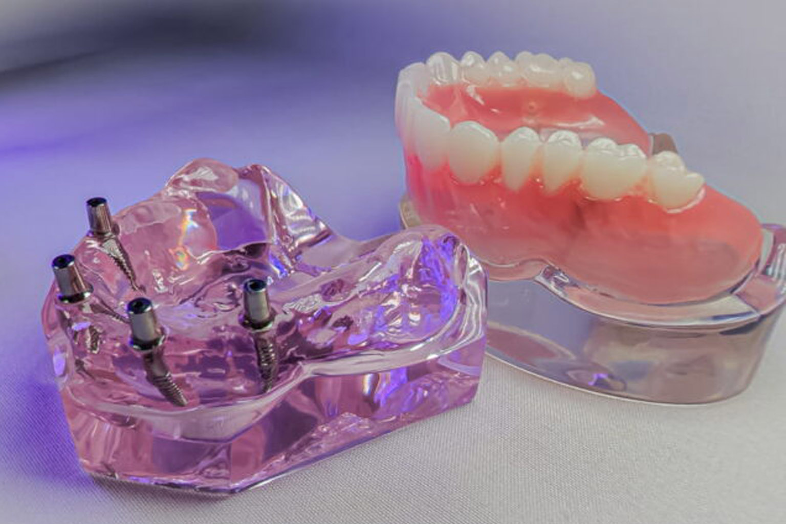 Implant model with visible abutments placed on a white surface, with a lower jaw denture in the background,
