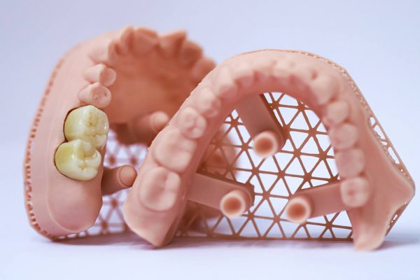 Same-Day Crowns